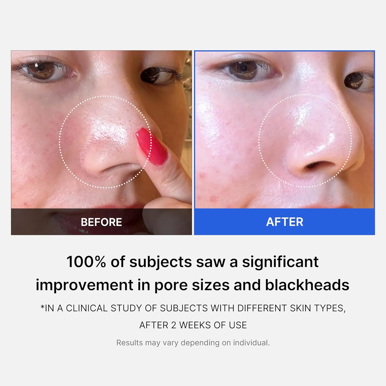 medicube - Zero Pore Pad 2.0